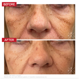 Before & after Pigment Control Drops – visibly even skin tone