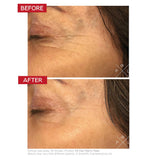 Before & after R3 Cell Matrix Mask – visibly smoother, plumper skin