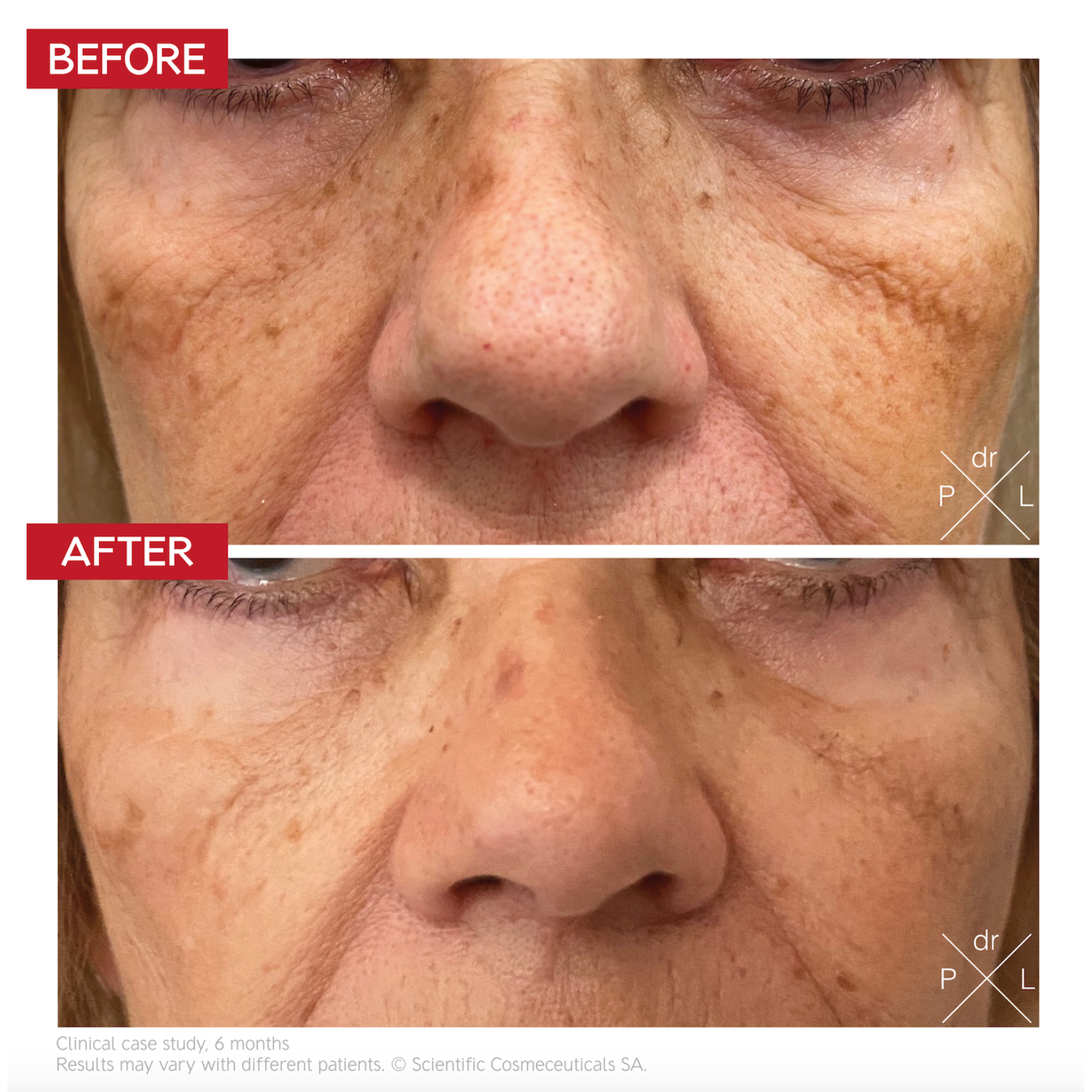 Before & after Pigment Control Drops – visibly even skin tone