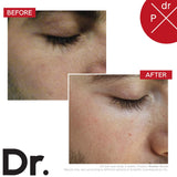 Before and after Booster Serum – smoother, firmer skin