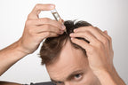 Applying Crescina Re-Growth to scalp – Swiss transdermic follicle stimulation